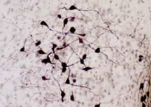 Oxytocin reagent - RA24604 - Neuromics - antibody / serum / immunohistochemistry