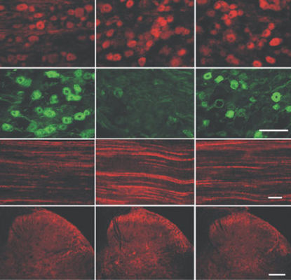 IgG reagent - GP10110 - Neuromics - for scientific research / immunohistochemistry / liquid