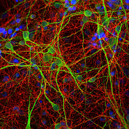 Antibody - MO22170 - Neuromics - for scientific research / for Western blot / immunohistochemistry