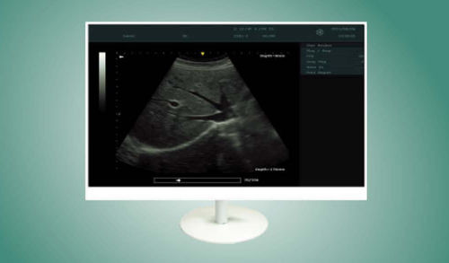 Medical display - MS2210 - ZRT Technology - endoscopy / 1920 x 1080 / 21.5"