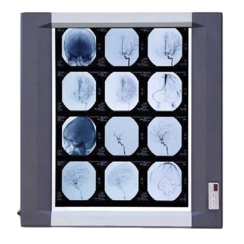 Digital X-ray film viewer - MV-FV5 - Mediveron - 1-screen / LED / adjustable brightness