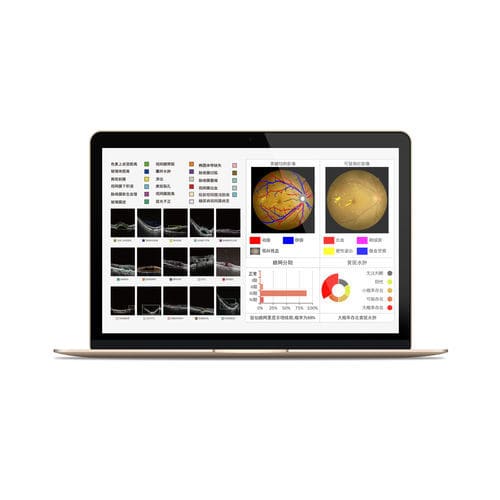 Analysis software - MIAS - Big Vision Medical - diagnostic / screening / medical
