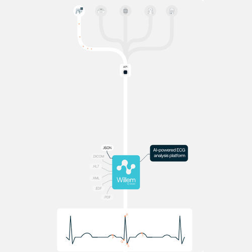 Medical AI platform - Willem - Idoven - for cardiology / diagnostic / analysis