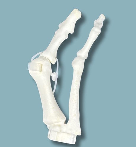 Metatarsal bone anatomical model - 01-09-01 - ADDIDREAM - orthopedic surgery / training / plastic