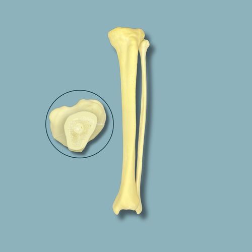 Tibia anatomical model - 03-09-01 - ADDIDREAM - fibula / surgery / training