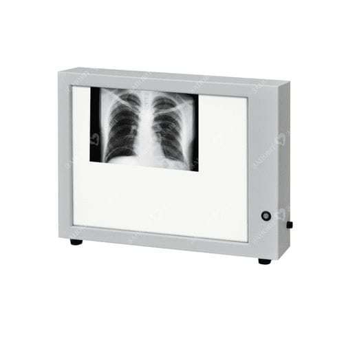1-screen X-ray film viewer - N-1 - Zapovit - with switch