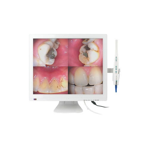 Intraoral camera - M-978V - Chuan Fu Medical Instrument Co., Ltd. - digital / CMOS