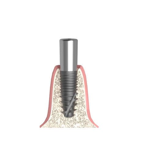Cylindrical healing abutment - Actival - Bionika Medline Kft. - internal / narrow / for dental clinics