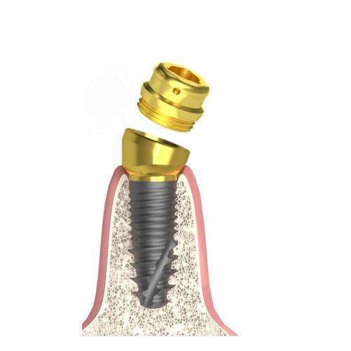 Cylindro-conical implant abutment - Actival - Bionika Medline Kft. - tapered / internal / screw