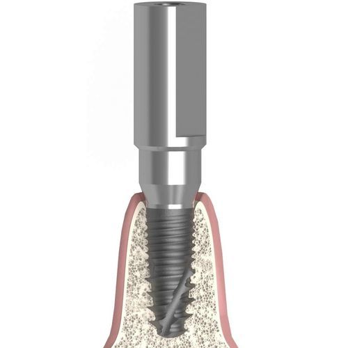 Intraoral scanbody - UNIFORM SIC® ace® max® - Bionika Medline Kft. - metal