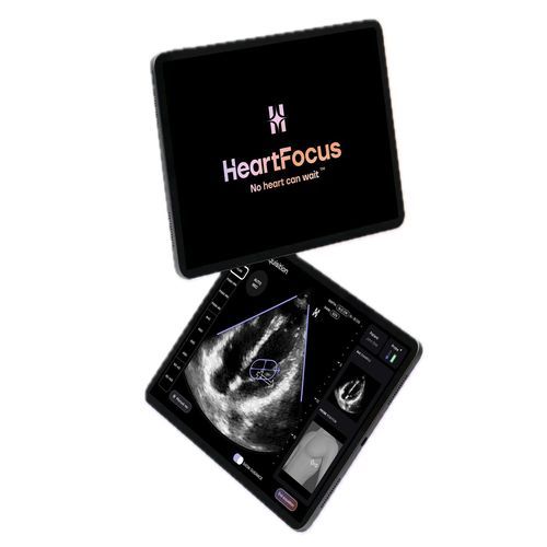 Echocardiography mobile application - HeartFocus - DESKI - diagnostic / reporting / monitoring