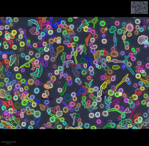 Artificial intelligence software - IMACEL - LPIXEL Inc. - image analysis / cell imaging / pathology macroscopic imaging