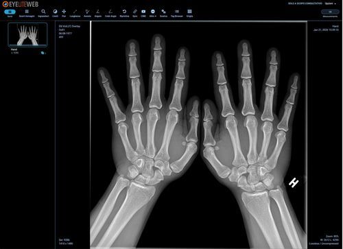 DICOM viewing software module - G-Squared