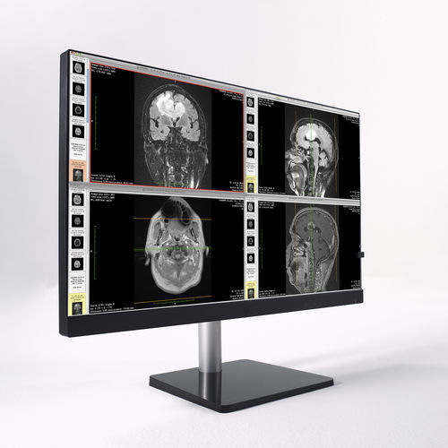 Medical imaging display - CL24N - Wide USA Corporation - full HD / 1920 x 1200 / 23.8"