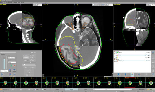 Treatment software - PCRT3D - Técnicas Radiofísicas S.L.U. - planning / treatment planning / training
