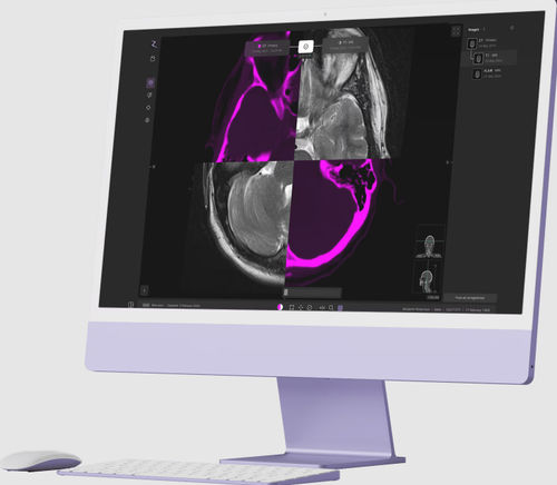 Medical software - zap-axon - ZAP Surgical Systems Inc - design / treatment / planning