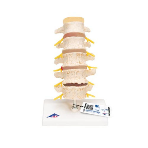 Vertebra anatomical model - A795  - 3B Scientific   - for teaching / hernia / disarticulated