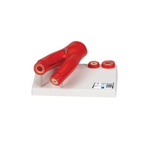 Artery vascular model - G40 - 3B Scientific   - for teaching / for atherosclerosis / with blood vessels