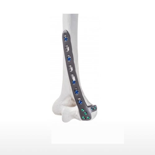 Humerus compression plate - 10-54183 - AF Medical   - distal / lateral / medial