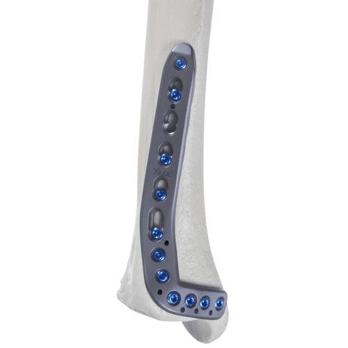 Tibia compression plate - 10-55 series - AF Medical   - distal / anterolateral / locking