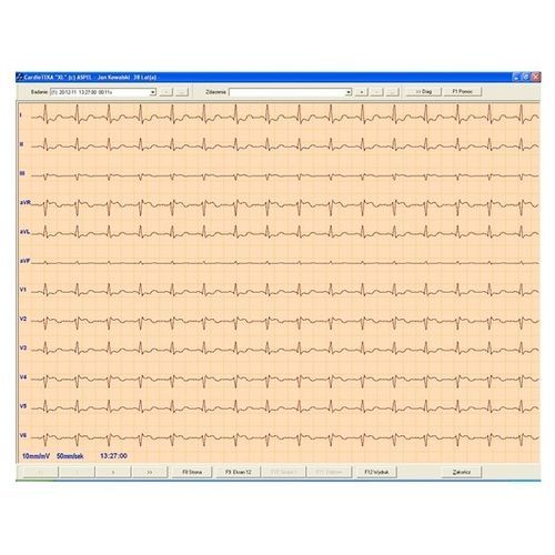 Viewer software - CARDIOTEKA v.211SOFTHL7 - ASPEL  - electrocardiography / heart / online