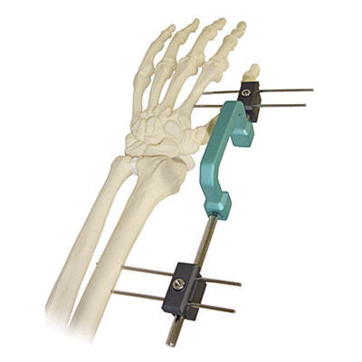 Wrist external fixation system - 568 - BAUMER  - tubular / adult