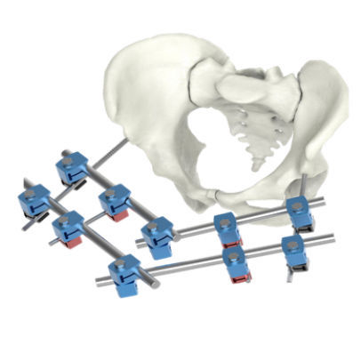 Pelvis external fixation system - BAUMER  - tubular / adult / pediatric