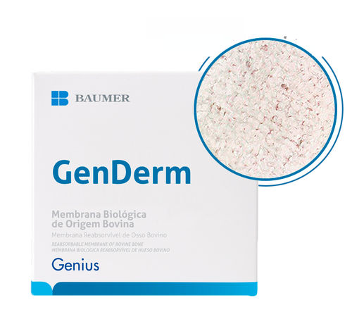 Buccal tissue matrix - GenDerm - BAUMER  - xenograft / transparent