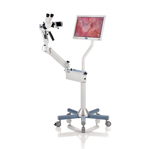 Video colposcope - C43 - Centrel   - binocular / trolley-mounted