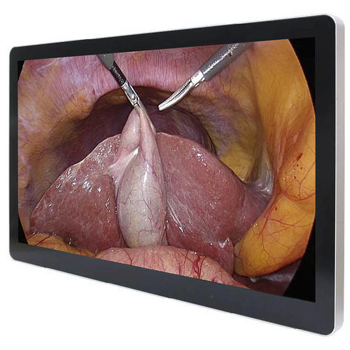 Medical monitor - ECONT-0501.1 - Contact Co. - surgical / full HD / 23.8"