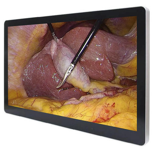 Medical monitor - ECONT-0501.5 - Contact Co. - surgical / 4K / 32"