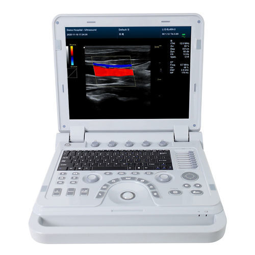 portable ultrasound system - Contec Medical Systems