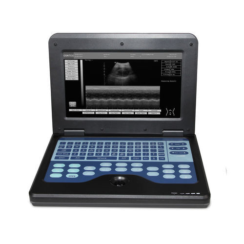 portable ultrasound system - Contec Medical Systems
