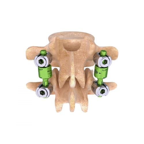 Thoraco-lumbo-sacral osteosynthesis unit - BDYN - Cousin Biotech - posterior / adult