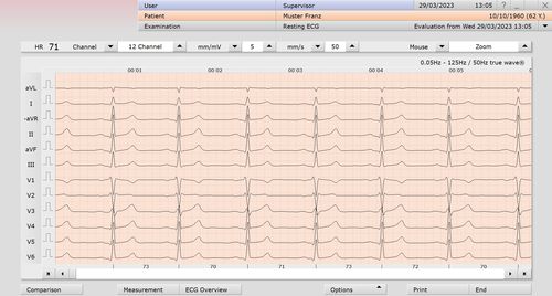 Analysis software module - custo med GmbH - measurement / diagnostic / electrocardiography