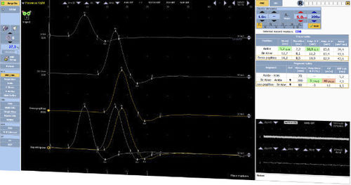 EMG software - DEYMED Diagnostic - monitoring / capture / nerve conduction