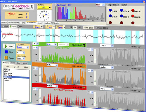 Design software - DEYMED Diagnostic - acquisition / training / EEG