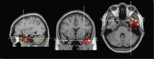 Visualization software - GeoSource 2.0 - Electrical Geodesics - medical / EEG