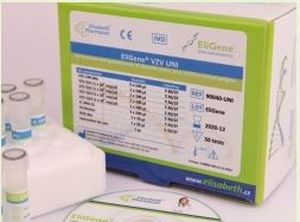 Encephalitis test kit - EliGene® TBEV LC  - Elisabeth Pharmacon spol  - for research / virus / clinical