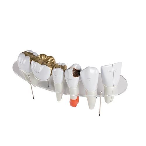 Tooth model - R10125 - Erler-Zimmer - dental / transparent