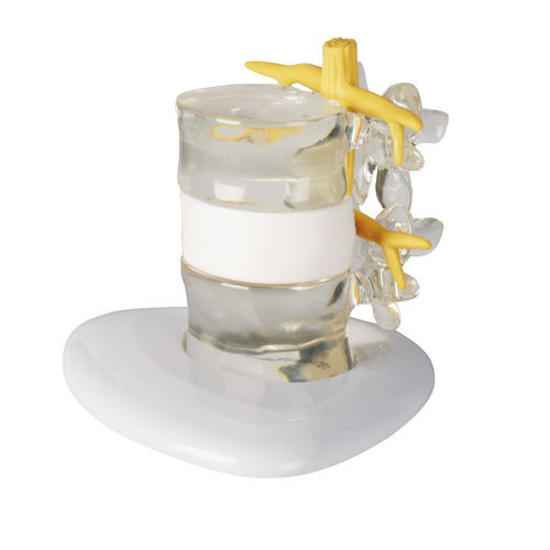 Lumbar vertebra anatomical model - 4400 - Erler-Zimmer - vertebra / training / transparent