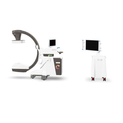 Mobile C-arm - alien e recharge - Eurocolumbus - with flat panel detector / with video column / with integrated video monitor