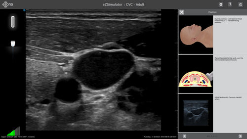 Training simulator - eZSimulator - eZono - for general care / ultrasound guided
