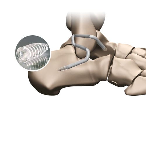 Gracilis tendon ligament prosthesis - 267 596 - FH Orthopedics - synthetic
