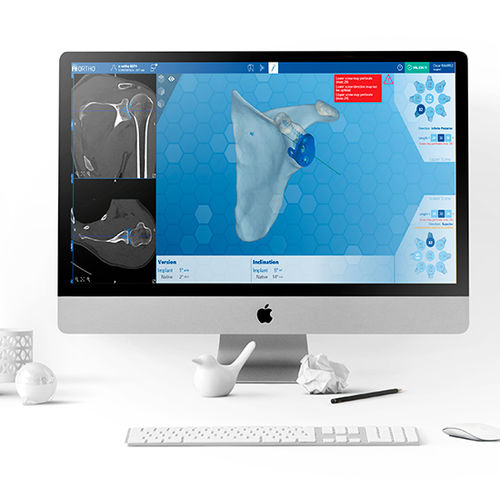 Shoulder surgery software - e-Ortho - FH Orthopedics - 3D viewing / prosthesis inspection / anatomy