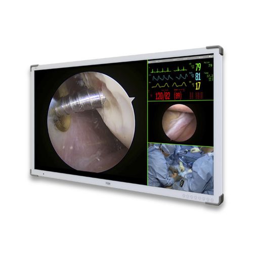 Medical display - FM-A5504DS - FSN Medical Technologies - operating room / 4K UHD / 55"