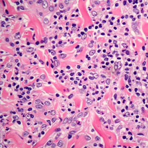 Stain reagent - Eosin Y 1% alcoholic solutions - Histo-Line Laboratories - for histology / liquid