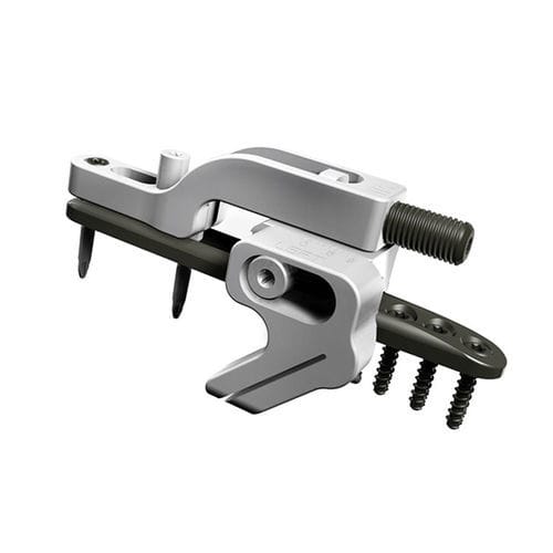 Ulna osteotomy plate - UOL 2 - I.T.S.   - distal / locking / metallic
