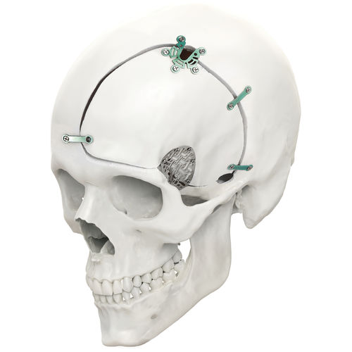 Non-absorbable cranial fixation system - LeForte Neuro 0.6 - Jeil Medical Corporation