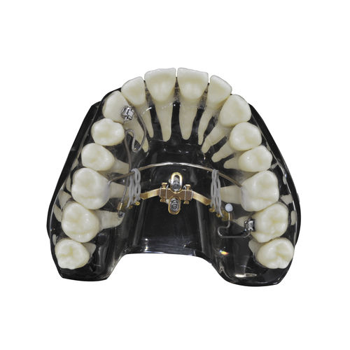 Tapered dental implant - LIM - Jeil Medical Corporation - titanium / external / straight